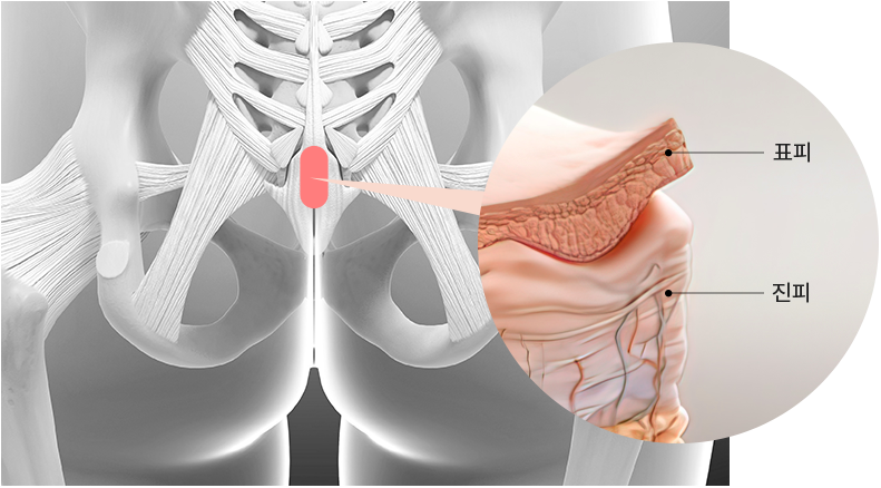 표피/진피 구조