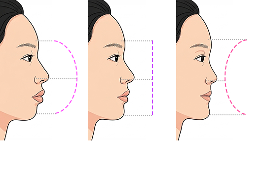 환자 케이스별 라인 설계