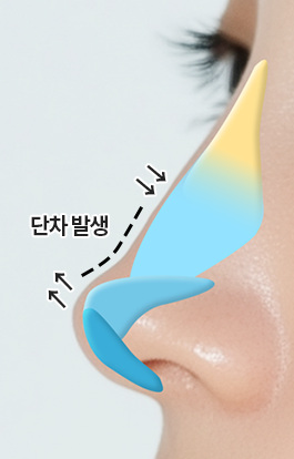 단차 개선 전