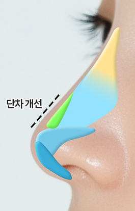 단차 개선 후
