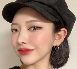 수술 후 사진 2